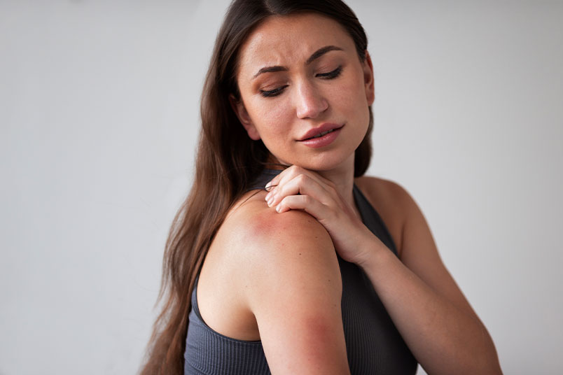 dermatitist