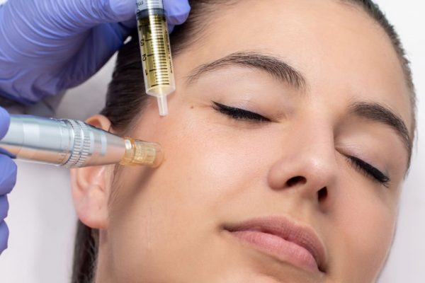 facialfiller Close up of young woman having cosmetic mesotherapy facial. Therapist injecting pharmaceuticals with derma pen on cheek.