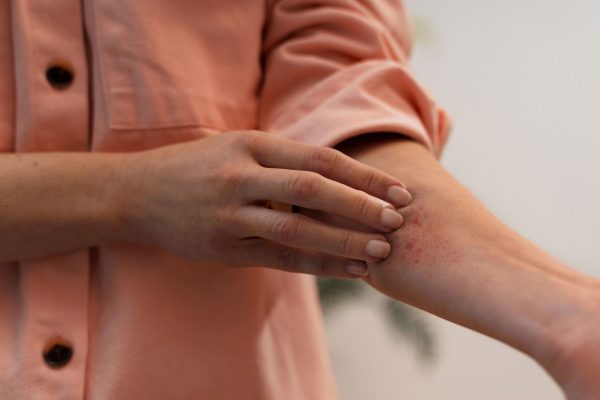 skininfections skininfections